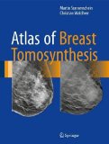 Atlas of Breast Tomosynthesis: Imaging Findings and Image-Guided Interventions