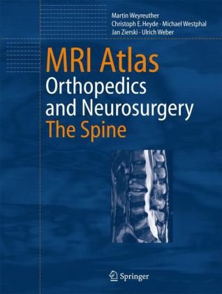 MRI Atlas: Orthopedics and Neurosurgery, The Spine