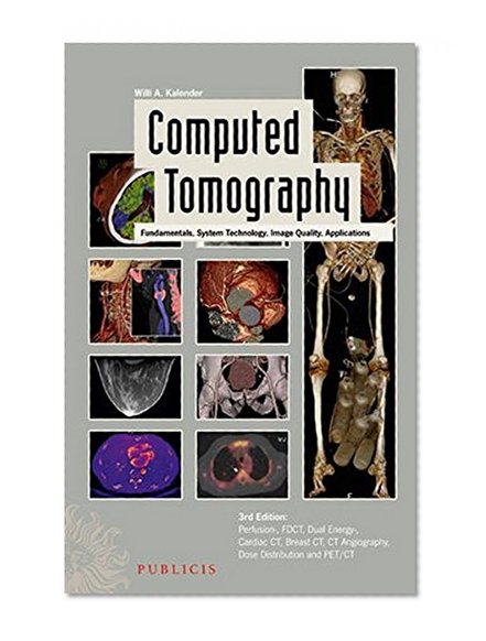 Computed Tomography: Fundamentals, System Technology, Image Quality, Applications