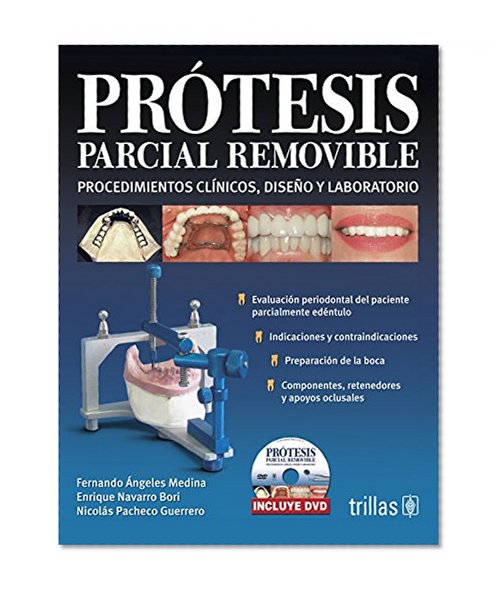 Protesis parcial removible / Removable Partial Denture: Procedimientos clinicos, diseno y laboratorio / Clinical Procedures, Laboratory and Design (Spanish Edition)