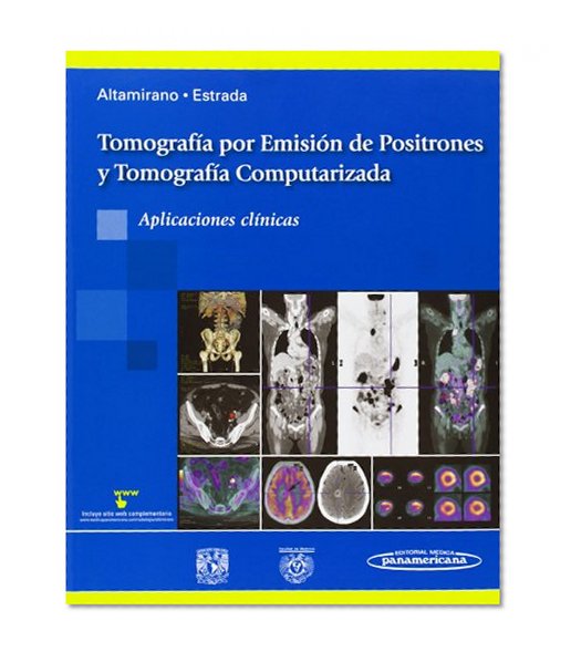 Tomografía por Emisión de Positrones y Tomografía Computarizada / Positron Emission Tomography and Computed Tomography: Aplicaciones Clínicas / Clinical Applications (Spanish Edition)