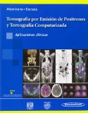 Tomografía por Emisión de Positrones y Tomografía Computarizada / Positron Emission Tomography and Computed Tomography: Aplicaciones Clínicas / Clinical Applications (Spanish Edition)