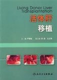 living donor liver transplantation