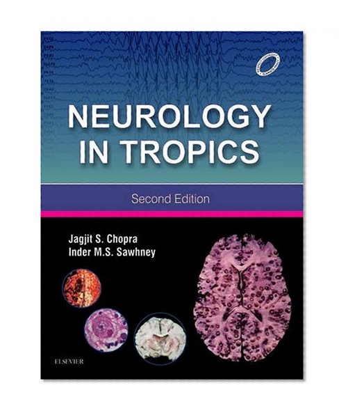 Neurology in Tropics