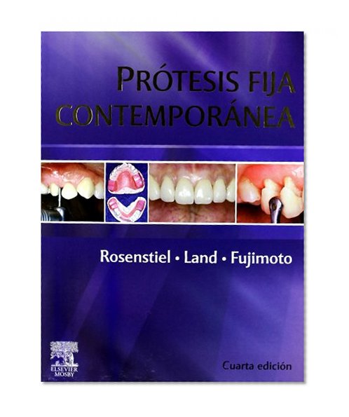 Book Cover Prótesis fija contemporánea, 4e (Spanish Edition)