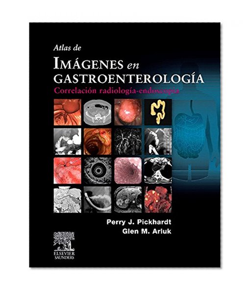 Atlas de imÃ¡genes en gastroenterologÃ­a: correlaciÃ³n radiologÃ­a-endoscopia