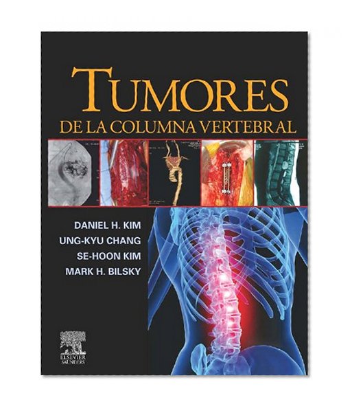 Tumores de la columna vertebral