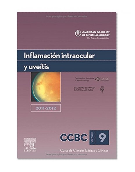 INFLAMACION INTRAOCULAR Y UVEITIS