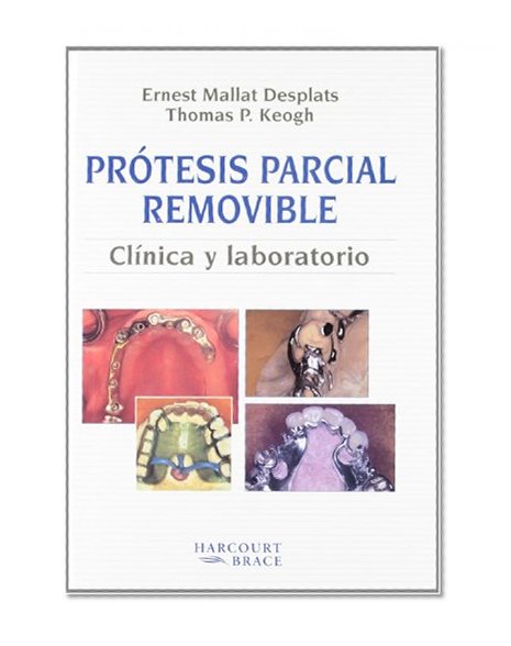 Book Cover PrÃ³tesis parcial removible. ClÃ­nica y laboratorio, 1e (Spanish Edition)
