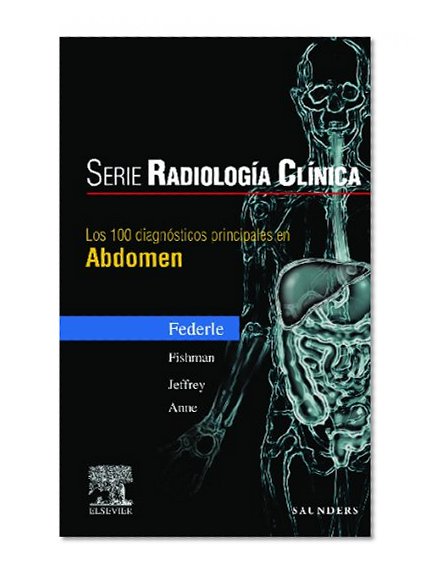 Book Cover Serie RadiologÃ­a ClÃ­nica: Los 100 diagnÃ³sticos principales en abdomen, 1e (Serie Pocket De Radiologia) (Spanish Edition)