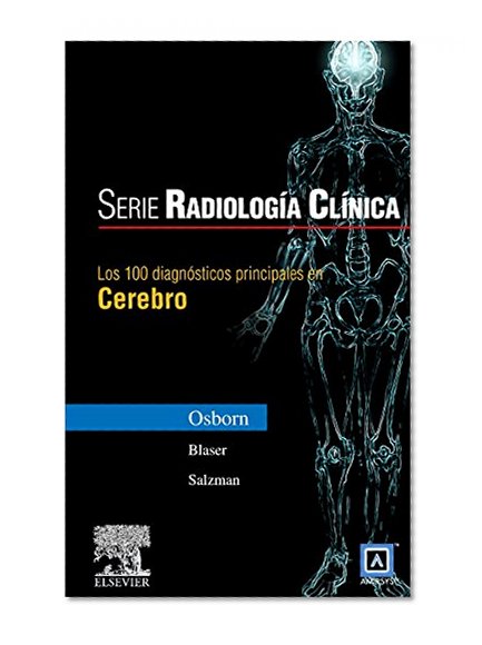 Book Cover Serie Radiología Clínica: Los 100 diagnósticos principales en cerebro, 1e (Serie Pocket De Radiologia) (Spanish Edition)
