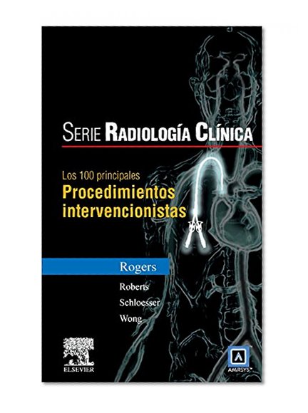 Book Cover Serie RadiologÃ­a ClÃ­nica: Los 100 diagnÃ³sticos principales en procedimientos intervencionistas, 1e (Serie Pocket De Radiologia) (Spanish Edition)