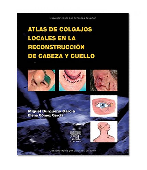Book Cover Atlas de colgajos locales en la reconstrucciÃ³n de cabeza y cuello, 1e (Spanish Edition)