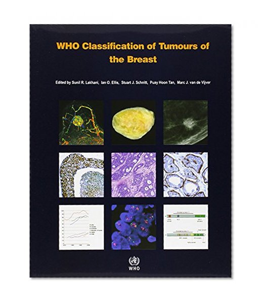 Book Cover WHO Classification of Tumours of the Breast (IARC WHO Classification of Tumours)