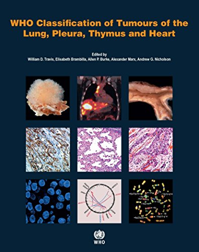 Book Cover WHO Classification of Tumours of the Lung, Pleura, Thymus and Heart (IARC WHO Classification of Tumours)