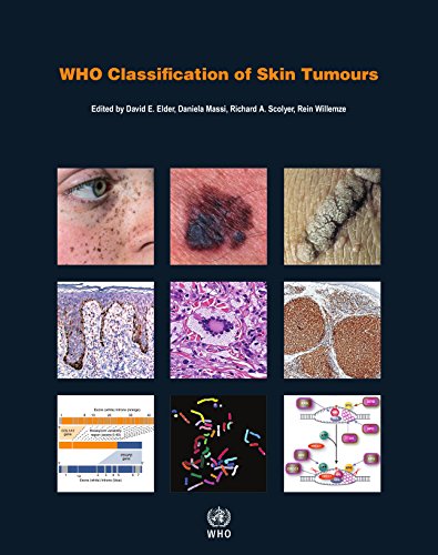 Book Cover WHO Classification of Skin Tumours (Medicine)