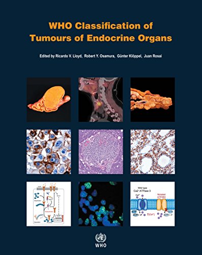 Book Cover WHO classification of tumours of endocrine organs (World Health Organization Classification of Tumours)