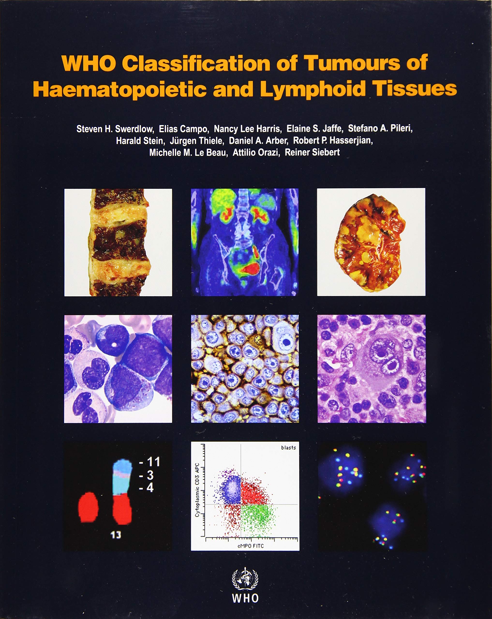 Book Cover WHO Classification of Tumours of Haematopoietic and Lymphoid Tissues