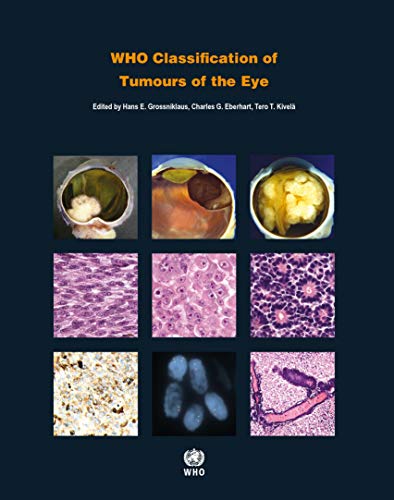 Book Cover WHO Classification of Tumours of the Eye