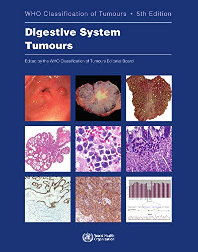 Book Cover Digestive system tumours: Who Classification of Tumours: 1 (World Health Organization Classification of Tumours)