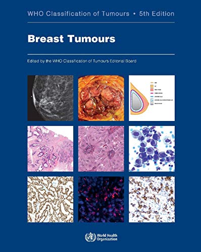 Book Cover Breast Tumours: WHO Classification of Tumours (Medicine)