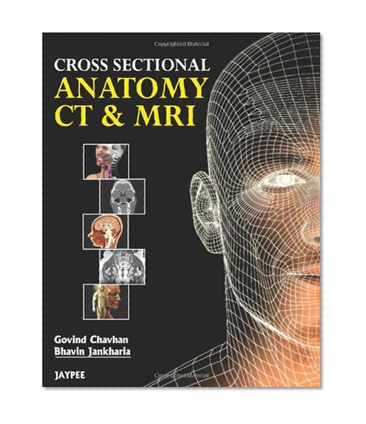 Book Cover Cross Sectional Anatomy CT & MRI