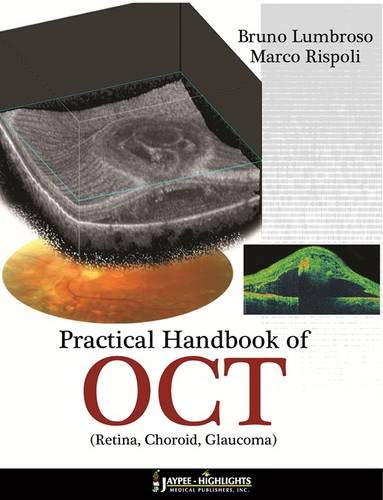 Practical Handbook of Oct: Retina, Choroid, Glaucoma