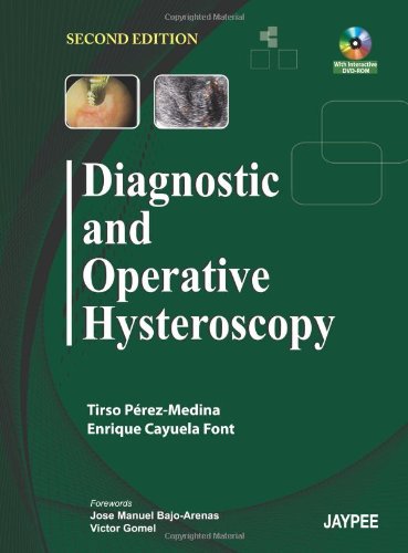 Book Cover Diagnostic and Operative Hysteroscopy