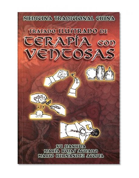 Tratado Ilustrado de Terapia con Ventosas. Medicina tradicional China. (Spanish Edition)