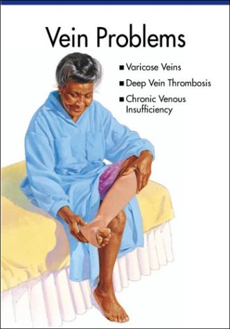 Vein Problems
