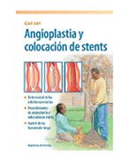 Angioplasty & Stenting, Understanding (Spanish) (Spanish Edition)