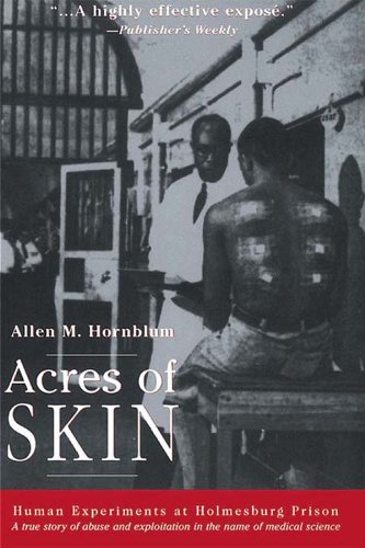Acres of Skin: Human Experiments at Holmesburg Prison