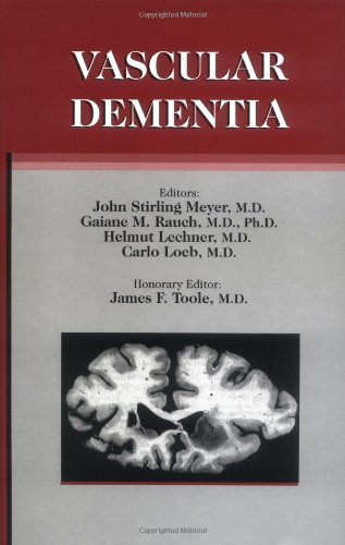 Vascular Dementia