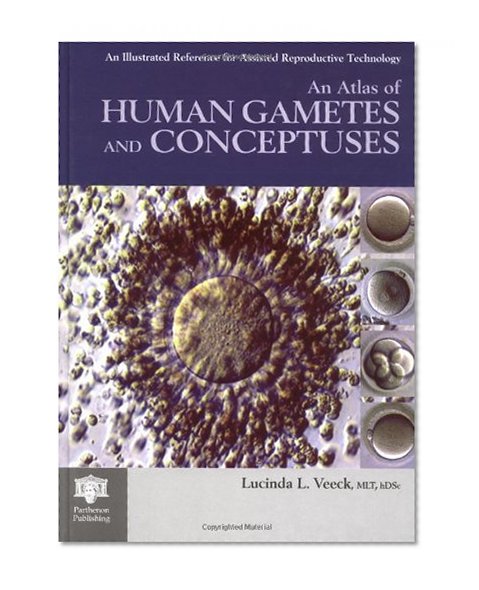 An Atlas of Human Gametes and Conceptuses: An Illustrated Reference for Assisted Reproductive Technology (The Encyclopedia of Visual Medicine Series)