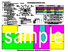 12 Lead ECG Ischemia Infarction Tool