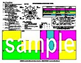 12 Lead ECG Ischemia Infarction Tool