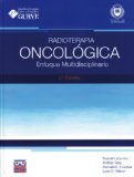 Radioterapia Oncologica Enfoque Multidisciplinario