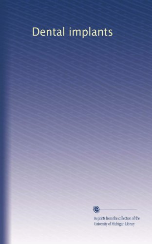 Dental implants