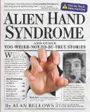 Alien Hand Syndrome