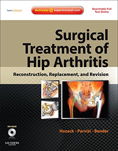 Surgical Treatment of Hip Arthritis: Reconstruction, Replacement, and Revision: Expert Consult