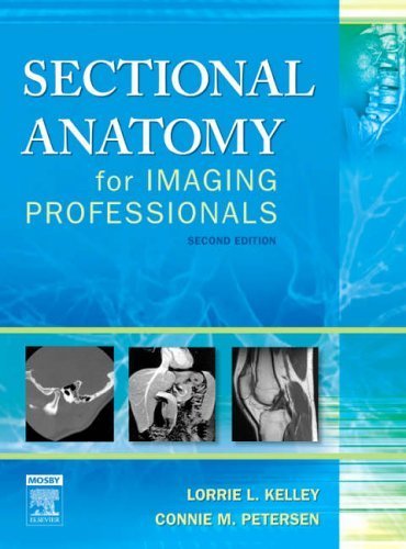 Sectional Anatomy for Imaging Professionals [Hardcover]