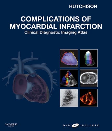 Complications of Myocardial Infarction: Clinical Diagnostic Imaging Atlas (Cardiovascular Emergencies: Atlas and Multimedia)