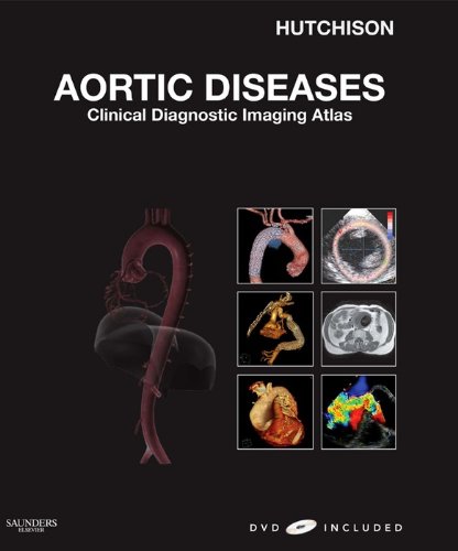 Aortic Diseases: Clinical Diagnostic Imaging Atlas (Cardiovascular Emergencies: Atlas and Multimedia)