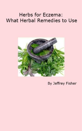 Herbs for Eczema: What Herbal Remedies to Use