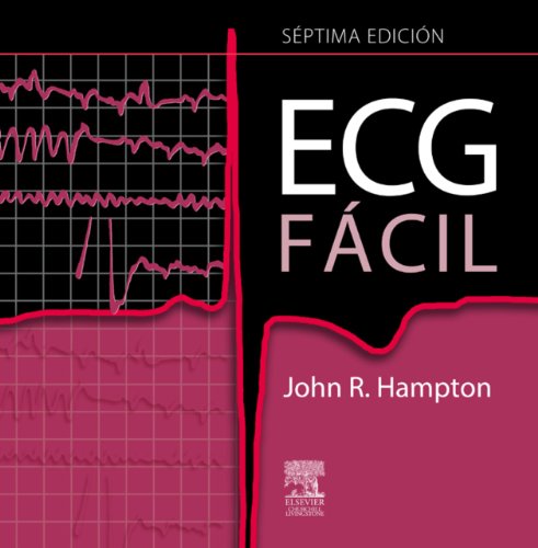 ECG fÃ¡cil: - (Spanish Edition)