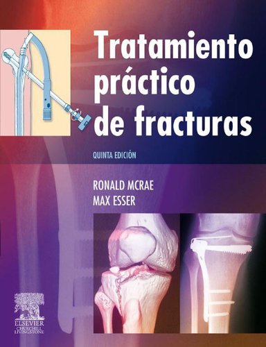 Tratamiento prÃ¡ctico de fracturas: - (Spanish Edition)
