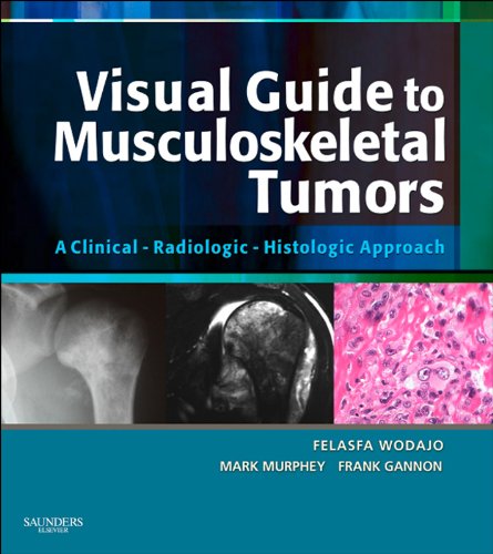Visual Guide to Musculoskeletal Tumors: A Clinical - Radiologic - Histologic Approach