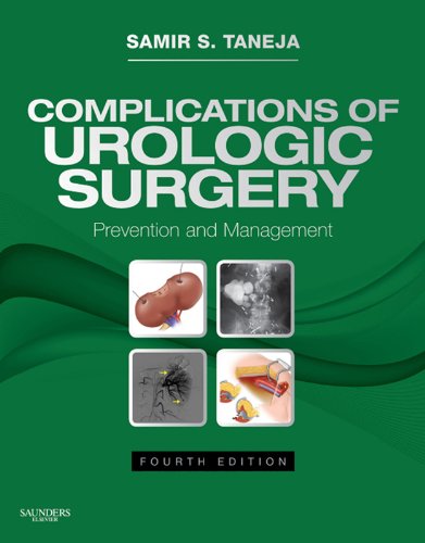 Complications of Urologic Surgery (Expert Consult Title: Online + Print)