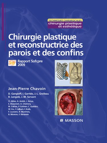 Chirurgie plastique et reconstructrice des parois et des confins: Rapport Sofcpre 2009 (French Edition)