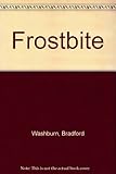 Frostbite